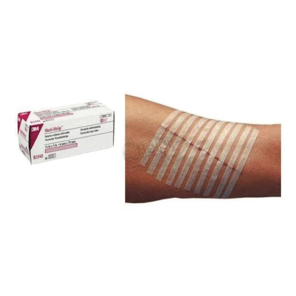 Steri-Strip Adhesive Skin Closures 6x100mm (10 Per Envelope) 50pk