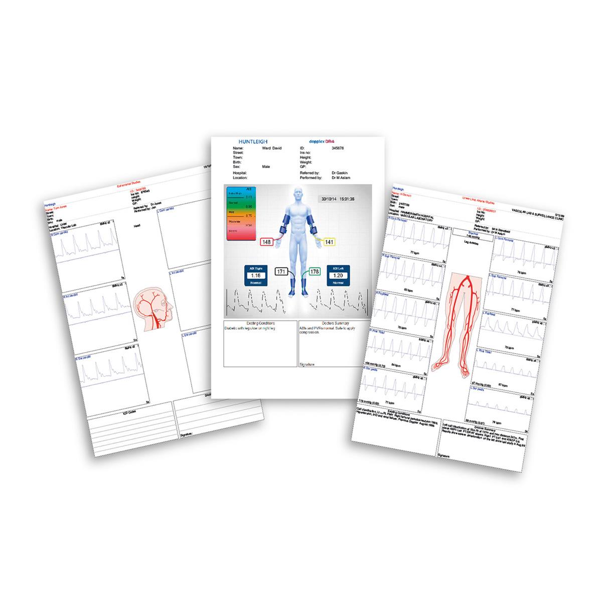 Huntleigh Std Paper For Ability Unit 5pk